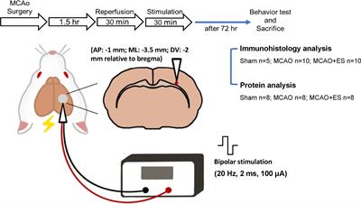 Somatosensory Cortical Electrical Stimulation After Reperfusion Attenuates Ischemia/Reperfusion Injury of Rat Brain